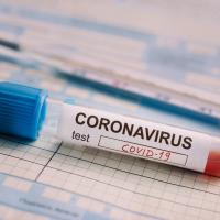 Medizinisches Teströhrchen mit der Aufschrift "Coronavirus" liegt auf einem Notizzettel.